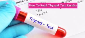 How To Read Thyroid Test Results – Learn From The Technician