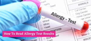 How To Read Allergy Test Results – It’s Not Hard As It Seems