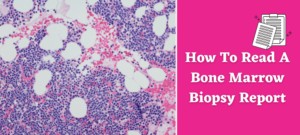How To Read A Bone Marrow Biopsy Report