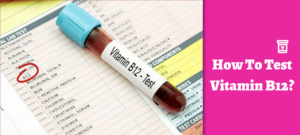 How To Test Vitamin B12?