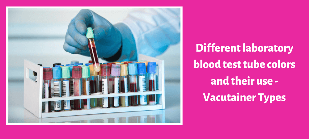 Different laboratory blood test tube colors and their use