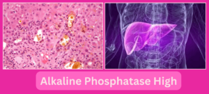 Alkaline Phosphatase High