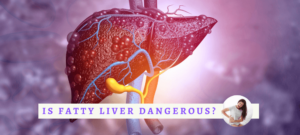 Is fatty liver dangerous? Stages of fatty liver
