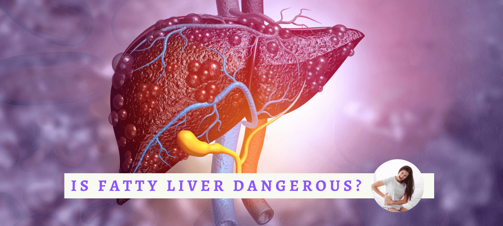 Is fatty liver dangerous?