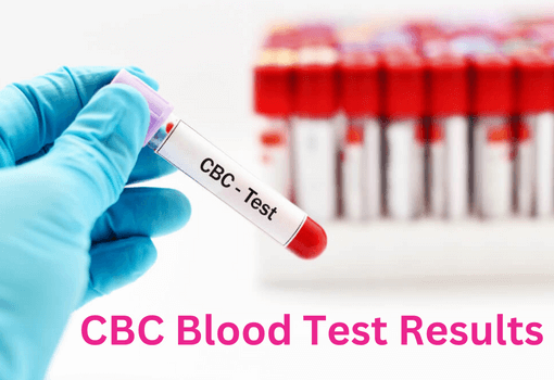 CBC blood test results 