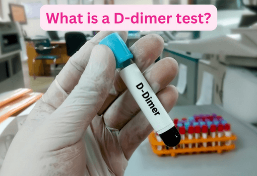 What is a D-dimer test