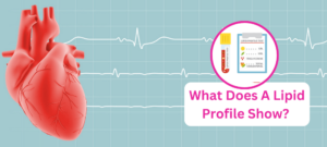 What does a lipid profile show?