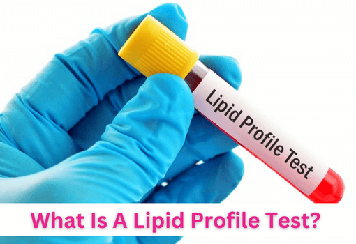 What is a lipid profile test