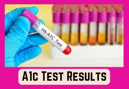 A1c Test Results