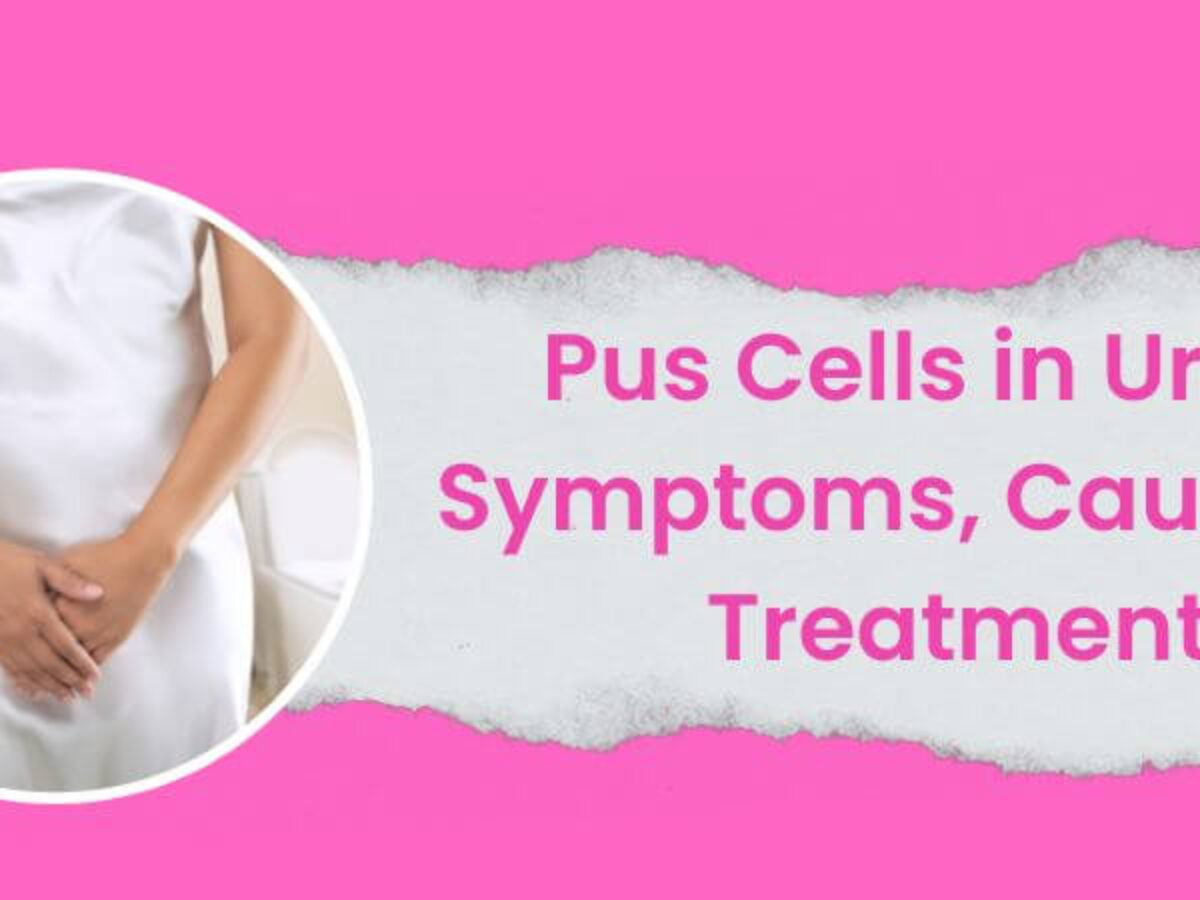 Pus Cells in Urine: Symptoms, Causes, & Treatment: Grace lab