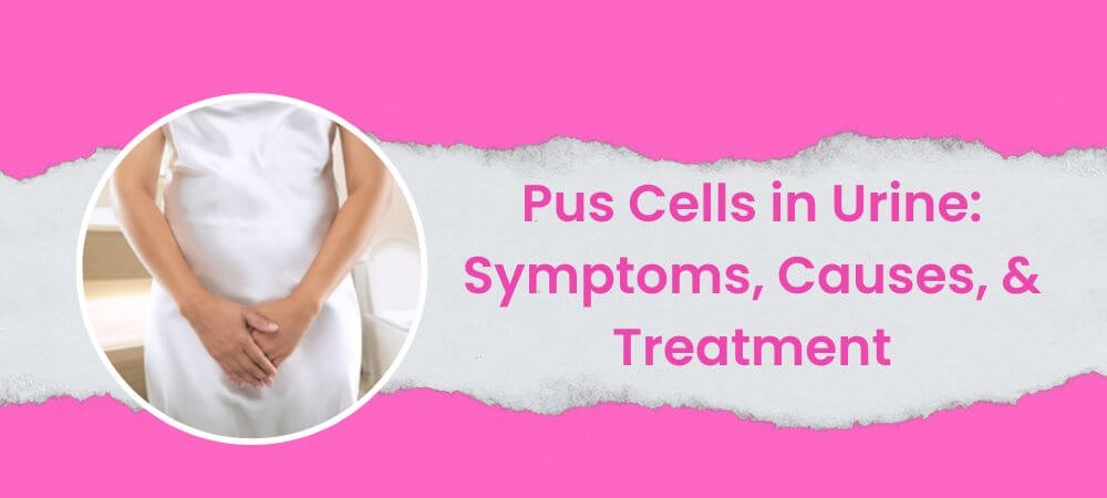 Pus Cells in Urine