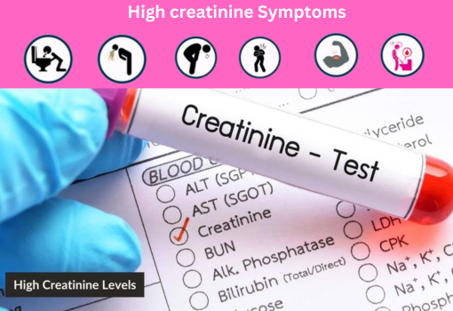 Symptoms of high creatinine