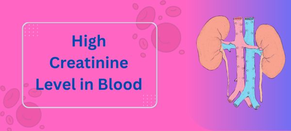 High Creatinine Level in Blood - Causes, Symptom & Diagnose