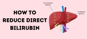 How To Reduce Direct Bilirubin – Cause and Prevention