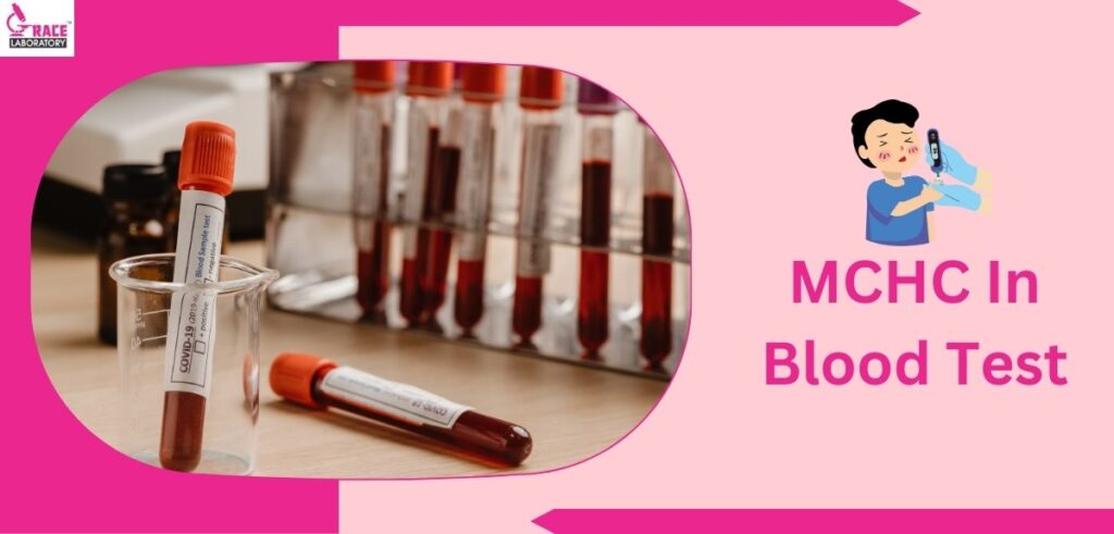 MCHC In Blood Test